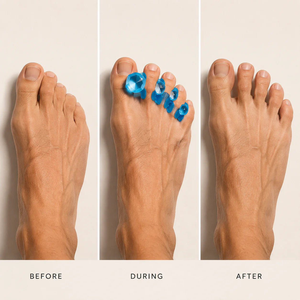 Toe Align Gems